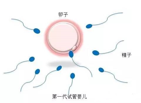 42岁成功案例